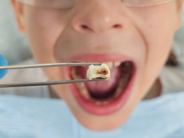 Best Knocked-Out Tooth Emergency  in Ahuimanu, HI